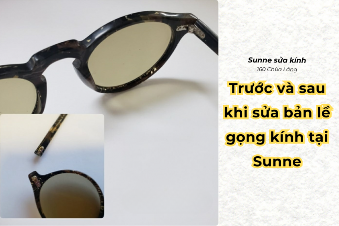 Hình ảnh thực tế: Trước và sau khi sửa bản lề gọng kính tại Sunne